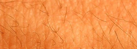 hair folicle vitiligo